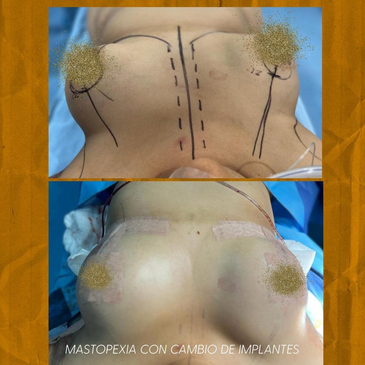 Slider image (3) Dr. Eduardo Cartagena Plastic and Reconstructive Surgeon
